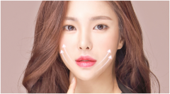 女明星永葆青春的秘诀——埋线提升