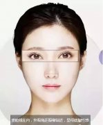 八大处杨欣：双眼皮的形状有几大类呢