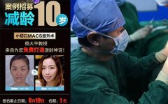 杨大平：【8月逆龄女神案例招募】免费减龄10岁，你还