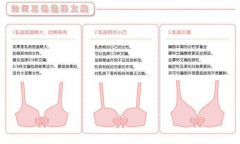 【热】胸部下垂松弛怎么解决？盘点最有效的方法