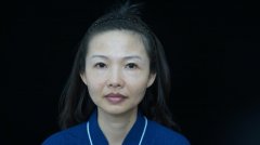 广州颜美荟张胜昌脂肪干细胞移植案例 赋予不一样的美