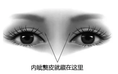 3.png