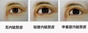 2.png