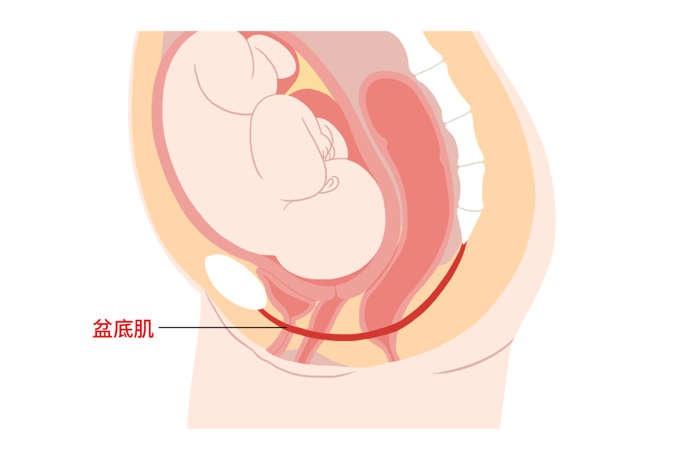 分娩对盆底肌的伤害.png