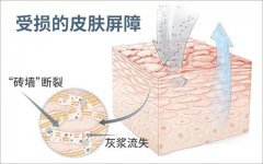 拒绝烂脸，修复皮肤屏障